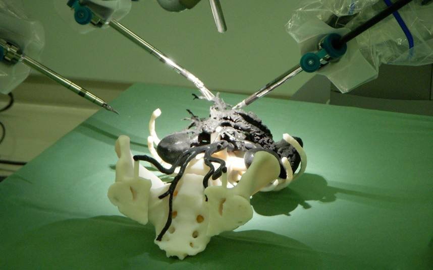 生物3D打印：成為未來醫學領域的破局者