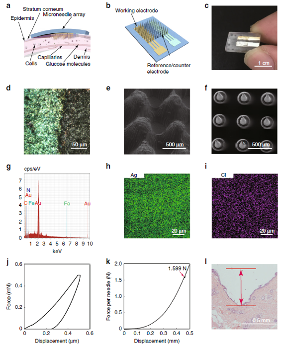 北京大學崔悅課題組《Microsystems & Nanoengineering》：3D打印微針生物傳感器用于糖尿病的持續監測