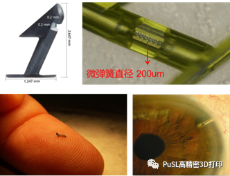 3D打印青光眼導流釘